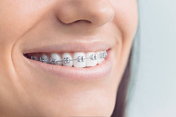 Why Choose Us for Your Dental Needs in Mapleton, UT